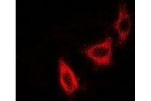 Immunofluorescent analysis of NUDE staining in SKOV3 cells. (NudE Neurodevelopment Protein 1 (NDE1) Antikörper)