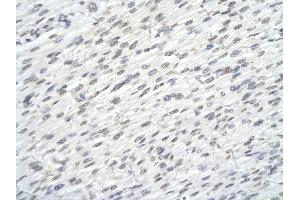 Rabbit Anti-SUPT6H antibody        Paraffin Embedded Tissue:  Human Heart cell   Cellular Data:  Epithelial cells of renal tubule  Antibody Concentration:   4. (Spt6 Antikörper  (N-Term))
