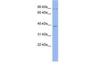 Image no. 1 for anti-Vacuolar Protein Sorting 72 Homolog (S. Cerevisiae) (VPS72) (AA 35-84) antibody (ABIN6741670)