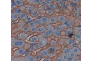 IHC-P analysis of Mouse Tissue, with DAB staining. (PIGR Antikörper  (AA 352-457))