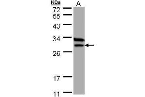 WB Image Sample (30 ug of whole cell lysate) A: MOLT4 , 12% SDS PAGE antibody diluted at 1:1000 (ETFB Antikörper)