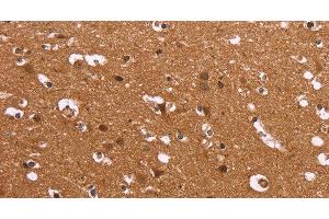 Immunohistochemistry of paraffin-embedded Human brain using HDLBP Polyclonal Antibody at dilution of 1:50 (HDLBP Antikörper)