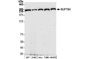 Western Blotting (WB) image for anti-Suppressor of Ty 6 Homolog (SUPT6H) (AA 425-475) antibody (ABIN7453850)