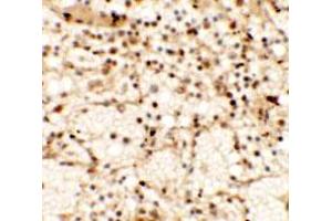 Immunohistochemical anyalysis of human spleen tissue with CLEC7A polyclonal antibody  at 5 ug/mL. (CLEC7A Antikörper  (Internal Region))