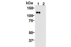 Western Blotting (WB) image for anti-Kinesin Family Member 11 (KIF11) (AA 1-1056), (N-Term) antibody (ABIN1449287) (KIF11 Antikörper  (N-Term))