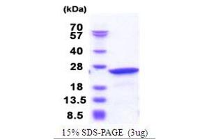 SDS-PAGE (SDS) image for Neuronal Calcium Sensor 1 (NCS1) (AA 1-190) protein (His tag) (ABIN5853871)