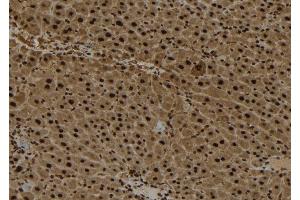 ABIN6272892 at 1/100 staining Mouse liver tissue by IHC-P. (AIMP2 Antikörper  (Internal Region))