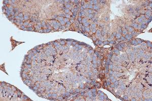 Immunohistochemistry of paraffin-embedded mouse testis using STK3/MST2 Rabbit mAb (ABIN7270223) at dilution of 1:100 (40x lens). (STK3 Antikörper)