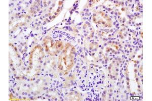 Formalin-fixed and paraffin embedded rat kidney labeled with Rabbit Anti Phospho-Bcl-2(Ser70) Polyclonal Antibody, Unconjugated (ABIN683428) at 1:200 followed by conjugation to the secondary antibody and DAB staining (Bcl-2 Antikörper  (pSer70))