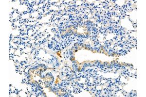 ABIN6265492 and ABIN6277002 at 1/100 staining Mouse kidney tissue by IHC-P. (TBXAS1 Antikörper  (N-Term))