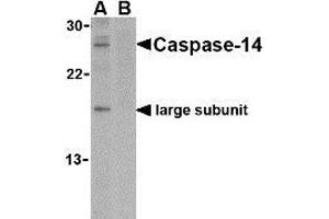 Western blot analysis of caspase-14 in Jurkat cell lysate in the (A) absence or (B) presence of blocking peptide with AP30195PU-N caspase-14 antibody at 1 μg/ml. (CASP14 Antikörper  (C-Term))