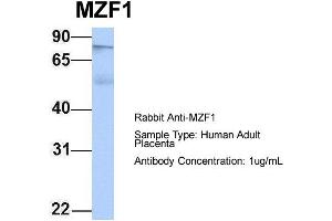 Host: Rabbit Target Name: MZF1 Sample Type: Human Adult Placenta Antibody Dilution: 1. (MZF1 Antikörper  (N-Term))