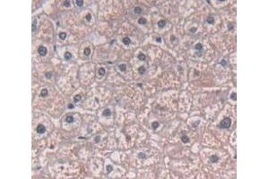 IHC-P analysis of Human Tissue, with DAB staining. (ADAM12 Antikörper  (AA 513-767))