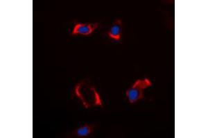 Immunofluorescent analysis of Cytochrome P450 2S1 staining in HepG2 cells.