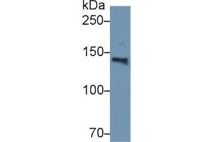 Detection of ORP150 in Human Serum using Polyclonal Antibody to 150 kDa Oxygen Regulated Protein (ORP150) (150 kDa Oxygen Regulated Protein (AA 695-994) Antikörper)