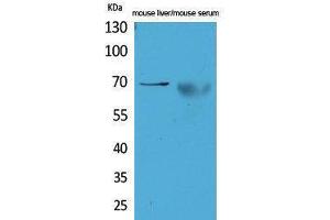 Western Blotting (WB) image for anti-alpha-Fetoprotein (AFP) (Internal Region) antibody (ABIN3180988)