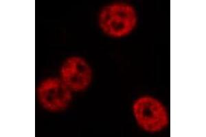 ABIN6277977 staining CoLo cells by IF/ICC. (FYB Antikörper)