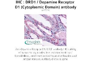 Image no. 1 for anti-Dopamine Receptor D1 (DRD1) (3rd Cytoplasmic Domain) antibody (ABIN1733780) (Dopamine Receptor d1 Antikörper  (3rd Cytoplasmic Domain))
