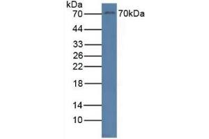 Detection of RYK in Human Jurkat Cells using Polyclonal Antibody to Related To Receptor Tyrosine Kinase (RYK) (RYK Antikörper  (AA 287-533))