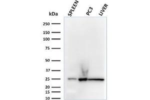 Western Blot Analysis of human spleen, PC3 and liver lysates using C1QA Mouse Monoclonal Antibody (C1QA/2783). (C1QA Antikörper  (AA 104-237))