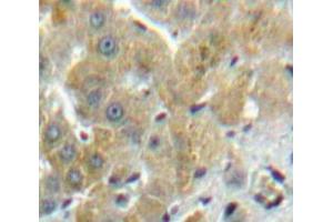 Used in DAB staining on fromalin fixed paraffin-embedded Liver tissue (FUCA1 Antikörper  (AA 170-420))