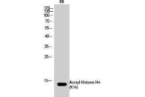 Western Blotting (WB) image for anti-Histone H4 (acLys16) antibody (ABIN3179374) (Histone H4 Antikörper  (acLys16))