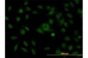Immunofluorescence of monoclonal antibody to STAG1 on HeLa cell. (Stromal Antigen 1 Antikörper  (AA 1112-1221))