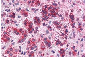 Human Adrenal: Formalin-Fixed, Paraffin-Embedded (FFPE) (TMEM33 Antikörper  (Internal Region))