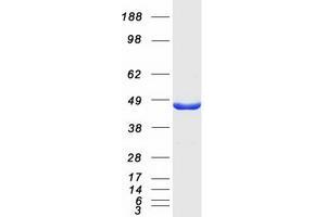 Western Blotting (WB) image for Jumonji Domain Containing 5 (JMJD5) (Transcript Variant 2) protein (Myc-DYKDDDDK Tag) (ABIN2723935)