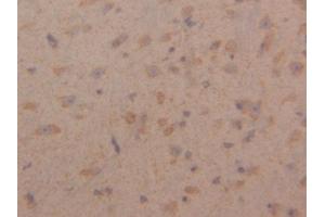 DAB staining on IHC-P; Samples: Mouse Cerebrum Tissue (Peroxiredoxin 3 Antikörper  (AA 64-257))