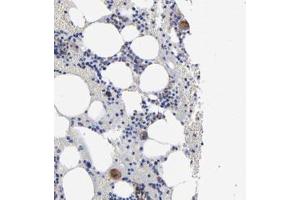 Immunohistochemical staining of human bone marrow with EMILIN1 polyclonal antibody  shows moderate cytoplasmic positivity in megakaryocytes. (Emilin1 Antikörper)