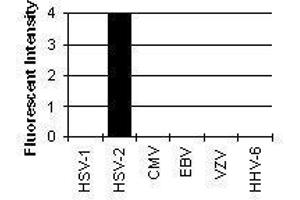 Cross Reactivity Results determined by IFA (HSV-2 gG Antikörper)