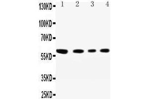 Western Blotting (WB) image for anti-Cell Adhesion Molecule 1 (CADM1) (AA 73-92), (N-Term) antibody (ABIN3042543) (CADM1 Antikörper  (N-Term))