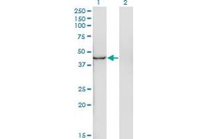 Western Blot analysis of INPP1 expression in transfected 293T cell line by INPP1 monoclonal antibody (M11), clone 4F9. (INPP1 Antikörper  (AA 300-399))
