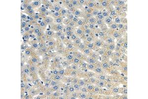 Immunohistochemistry of paraffin embedded mouse liver using CEACAM1 (ABIN7073315) at dilution of 1: 650 (400x lens) (CEACAM1 Antikörper)