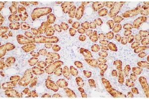 Immunohistochemistry of paraffin-embedded Rat kidney using GSTA1 Polycloanl Antibody at dilution of 1:200 (GSTA1 Antikörper)