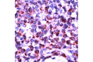Human tonsil stained with Anti-Bak antibody (BAK1 Antikörper  (N-Term))