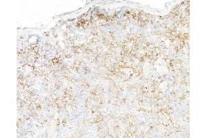 Immunohistochemistry (IHC) image for anti-Ectonucleoside Triphosphate diphosphohydrolase 1 (ENTPD1) (AA 300-350) antibody (ABIN7795686)