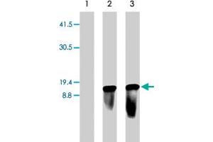 Western blot of 293 cells mock transfected (lane 1) or transiently transfected with pLenti6/TR lentiviral vector (lanes 2 & 3). (Blasticidin S Deaminase Antikörper  (N-Term))