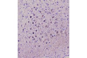 IHC analysis of NSE using anti-NSE antibody (ABIN6719549). (ENO2/NSE Antikörper)