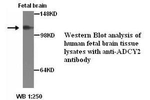 Image no. 1 for anti-Adenylate Cyclase 2 (Brain) (ADCY2) antibody (ABIN1574475) (ADCY2 Antikörper)