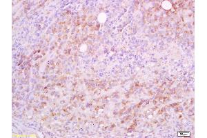 Formalin-fixed and paraffin embedded mouse lymphoma tissue labeled with Anti-CD5L/Api6 Polyclonal Antibody, Unconjugated (ABIN740985) at 1:200 followed by conjugation to the secondary antibody and DAB staining (CD5L Antikörper  (AA 221-347))