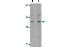 Western blot analysis of RASD2 in human colon tissue lysate with RASD2 polyclonal antibody  at (A) 1 and (B) 2 ug/mL . (RASD2 Antikörper  (C-Term))