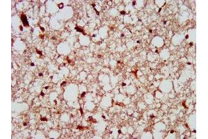 IHC image of ABIN7174093 diluted at 1:300 and staining in paraffin-embedded human brain tissue performed on a Leica BondTM system.