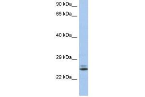 RAB15 antibody used at 1 ug/ml to detect target protein.
