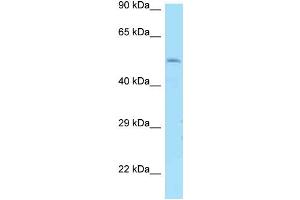 WB Suggested Anti-DRD1 Antibody Titration: 1. (Dopamine Receptor d1 Antikörper  (N-Term))