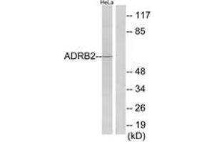 Western blot analysis of extracts from HeLa cells, using ADRB2 Antibody. (beta 2 Adrenergic Receptor Antikörper  (AA 201-250))