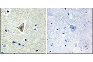 Immunohistochemistry analysis of paraffin-embedded human brain tissue, using CDH20 Antibody. (Cadherin 20 Antikörper  (AA 111-160))