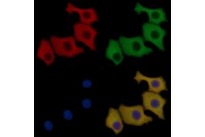 AQP4 Mouse Monoclonal Antibody staining HepG2 cells by IF/ICC.