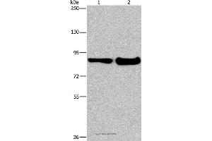 Western blot analysis of Mouse lung and liver tissue, using ECE1 Polyclonal Antibody at dilution of 1:1050 (MAPRE3 Antikörper)